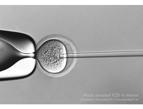 Eppendorf_Cell-Technology_PIEZO-assisted-ICSI-mouse_microscope